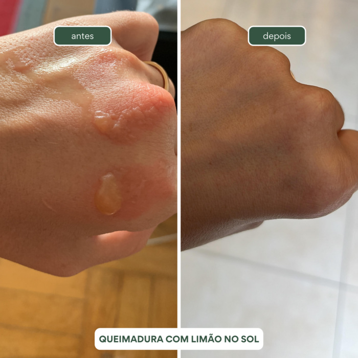 Compre 3 Leve 4 - Gel de Babosa 250ml - Imagem 7