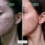Hidratante facial todos os tipos de pele ORVALHO+ - Cupuaçu e Esqualano - 60ml - Imagem 6