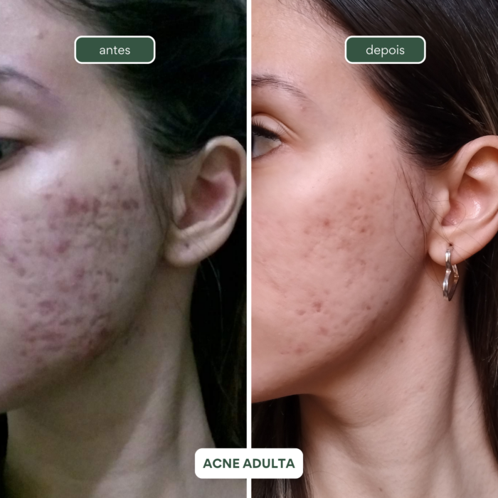 Hidratante facial todos os tipos de pele ORVALHO+ - Cupuaçu e Esqualano - 60ml - Imagem 6